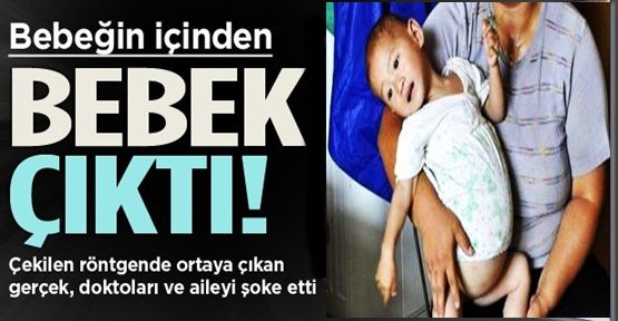 Bebeğin İçinden Bebek Çıktı!