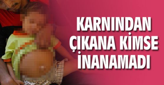 Karnından kardeşi çıktı !