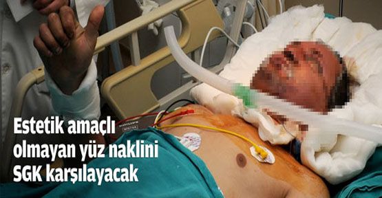 Tedavi maksatlı yüz nakli masrafını SGK karşılayacak