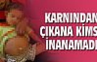 Karnından kardeşi çıktı !